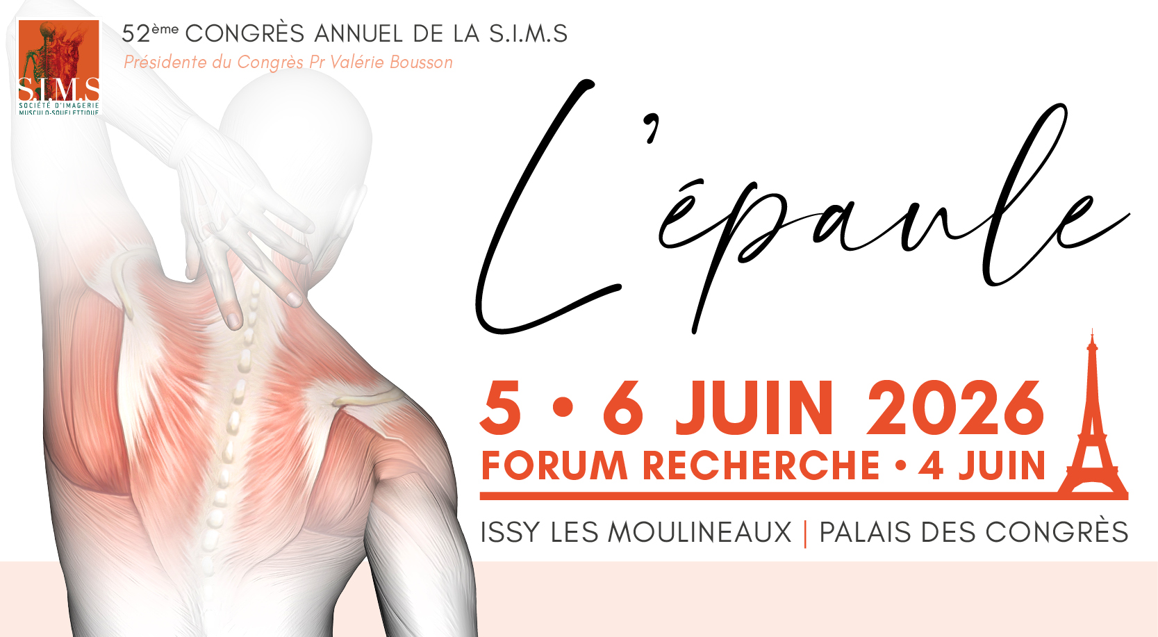 52<sup>ème</sup> Congrès Annuel de la S.I.M.S. – L’épaule