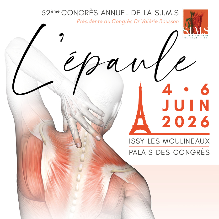 52<sup>ème</sup> Congrès Annuel de la S.I.M.S. – L&rsquo;épaule
