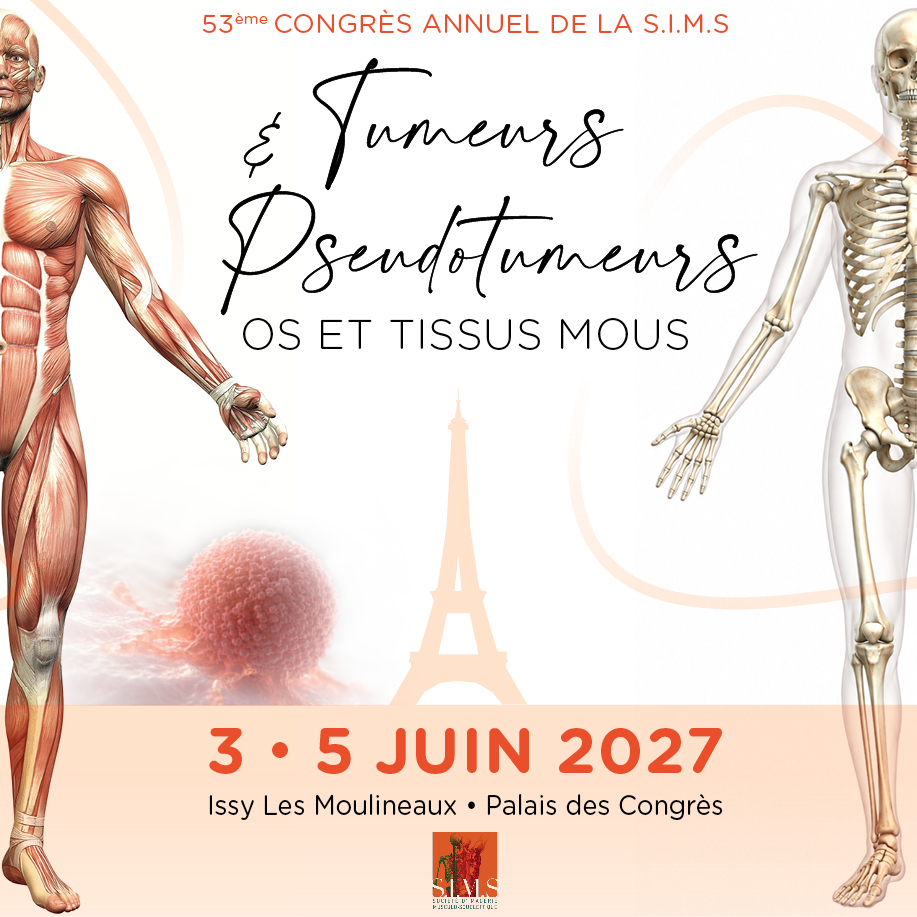 53<sup>ème</sup> Congrès Annuel de la S.I.M.S. – Tumeurs & Pseudotumeurs
